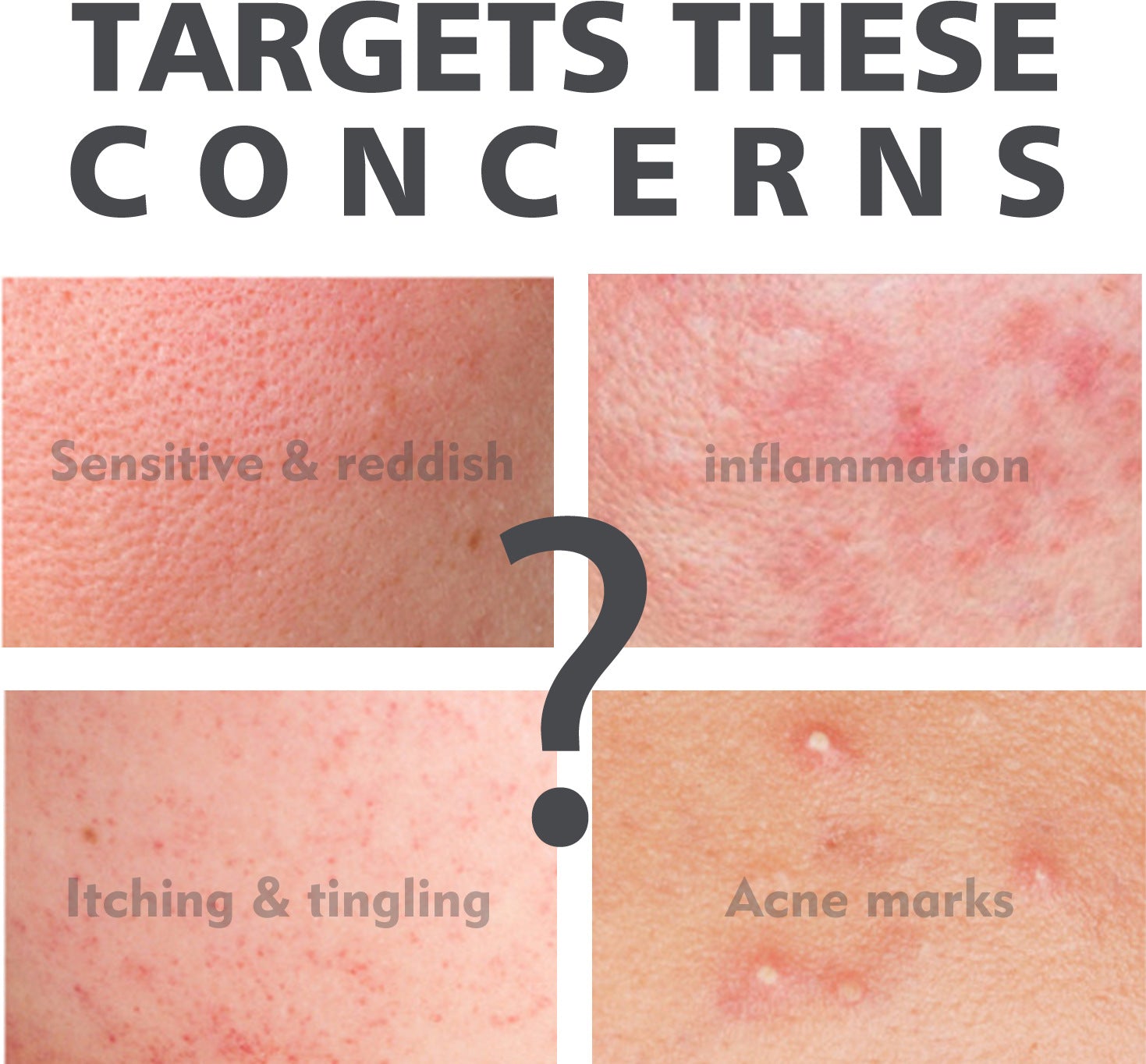 Eau de soin pour peau acnéique au salicylate, soin réparateur pour la peau, flacon transparent avec liquide clair