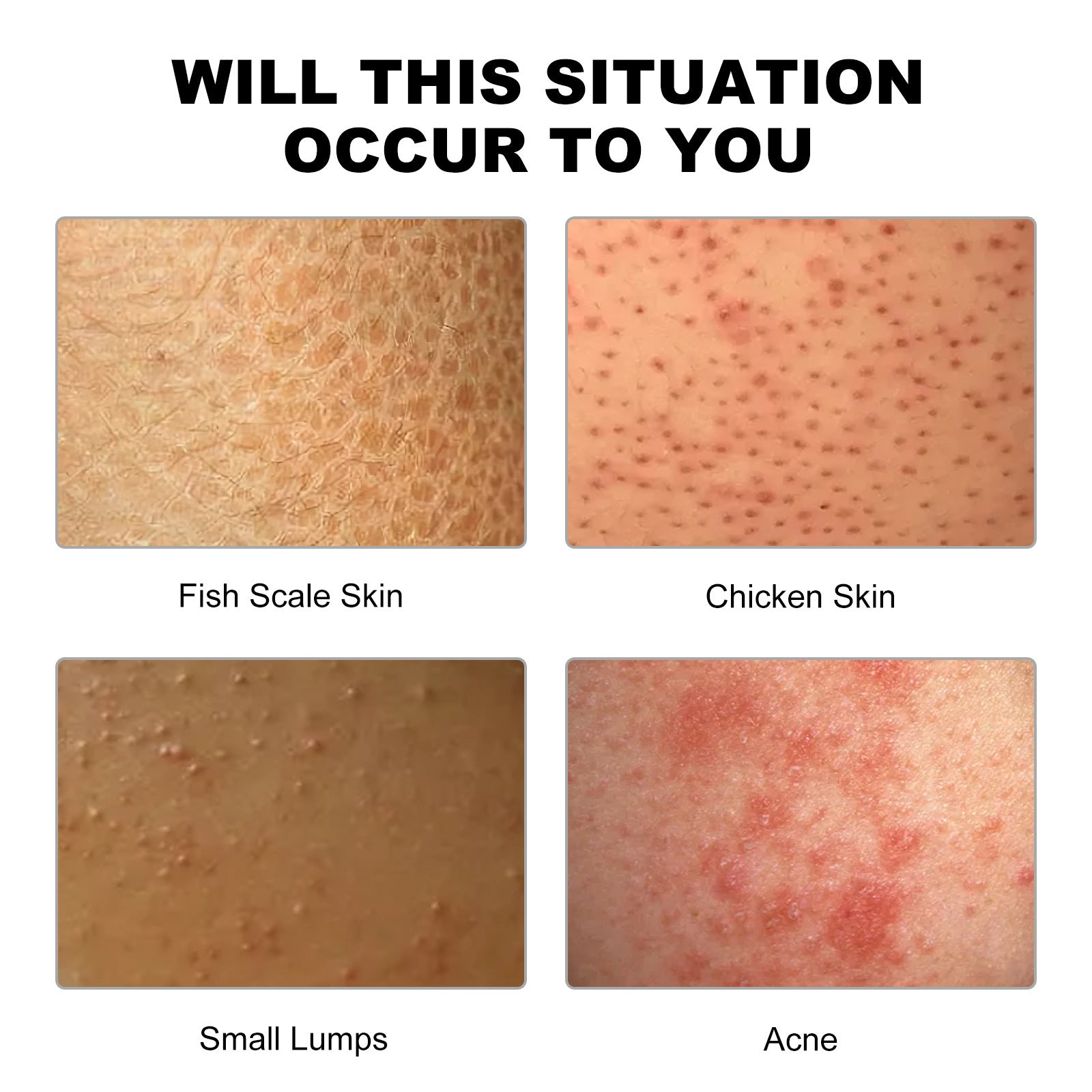 Crème nettoyante profonde pour peau acnéique, hydratante, purifiante, élimine les impuretés et resserre les pores.